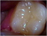 Caroline Dental